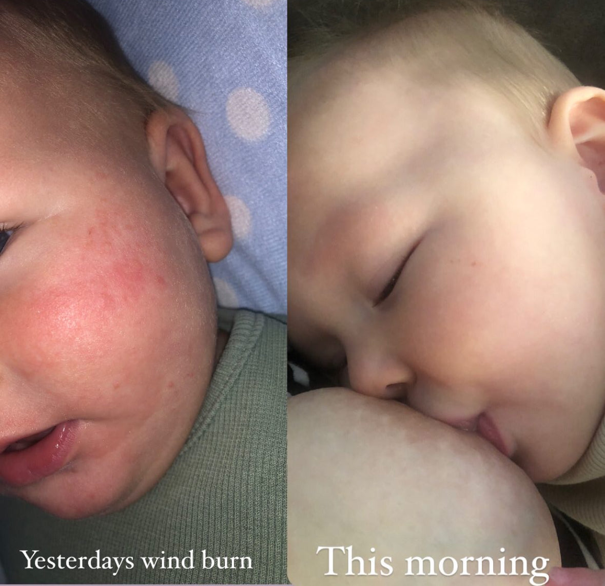 Tallow Baby Balm