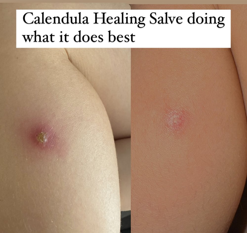Calendula Healing Salve